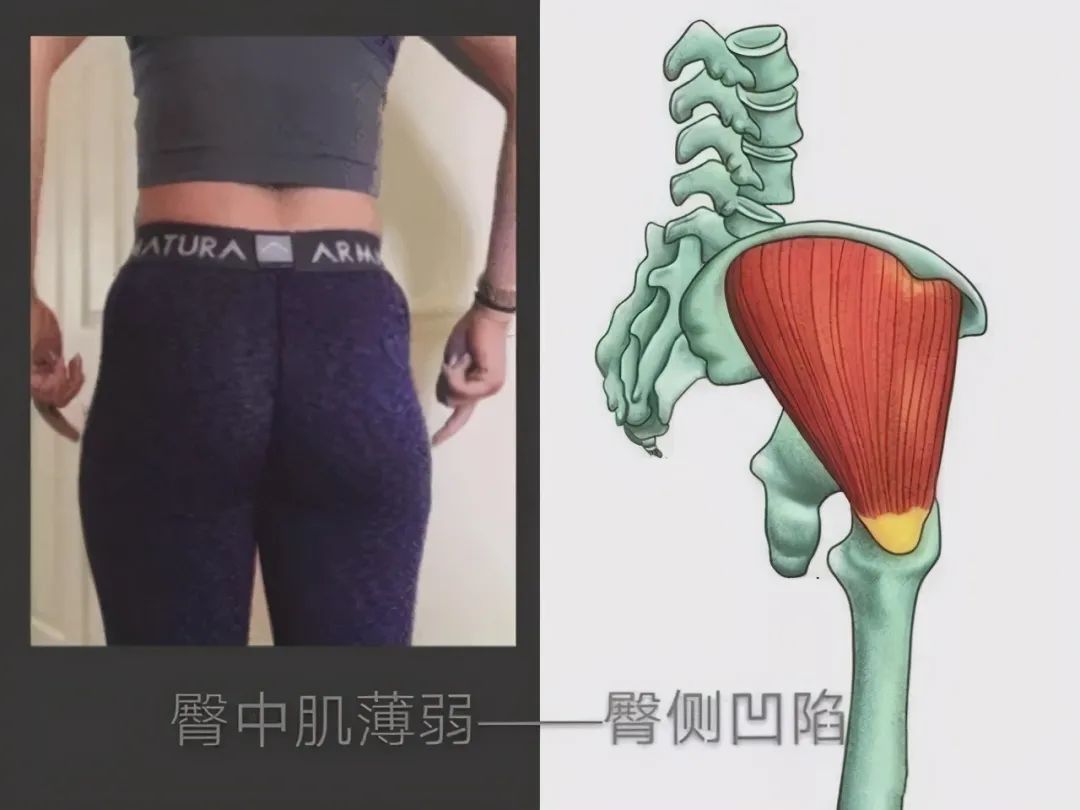 臀中肌该怎么训练(图1)